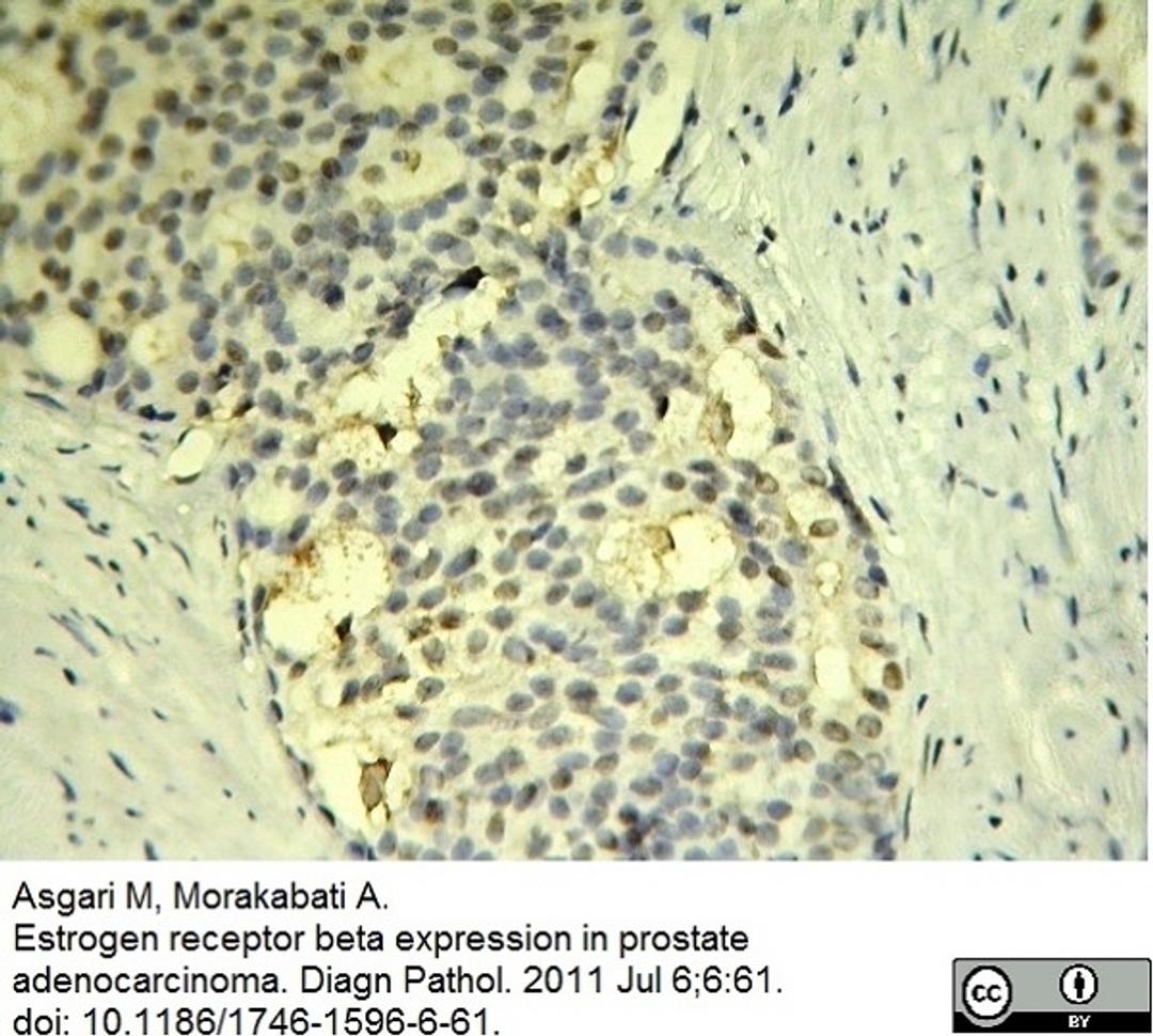 Mouse anti Human Estrogen receptor beta 1 antibody used for the identification of ER-beta