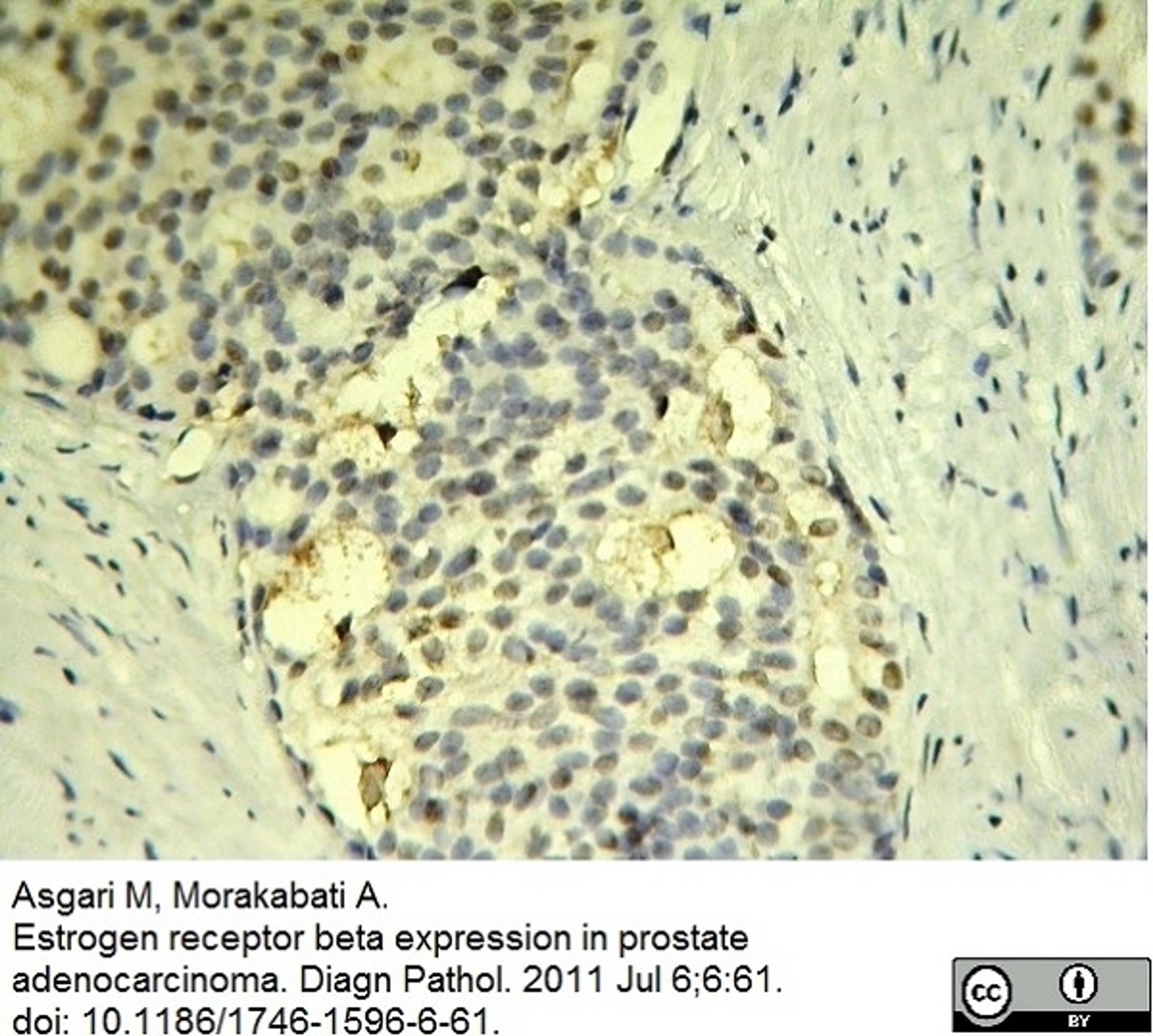 Mouse anti Human Estrogen receptor beta 1 antibody used for the identification of ER-beta