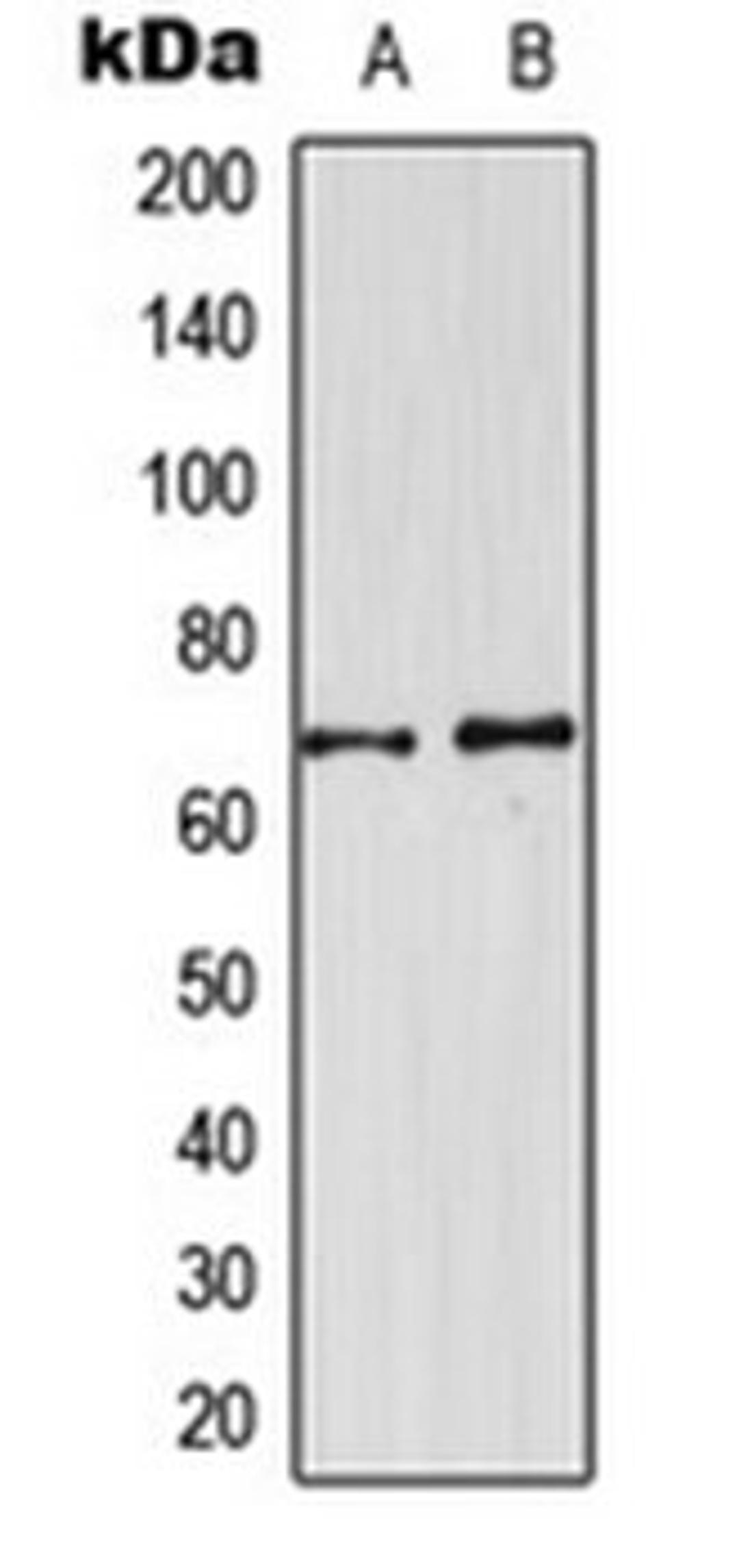 Western blot analysis of U251MG (Lane 1), NIH3T3 (Lane 2) whole cell lysates using CDKL3 antibody