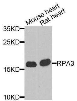 Western blot analysis of extracts of various cells using RPA3 antibody