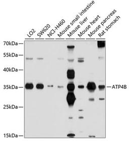 Western blot - ATP4B antibody (A10106)