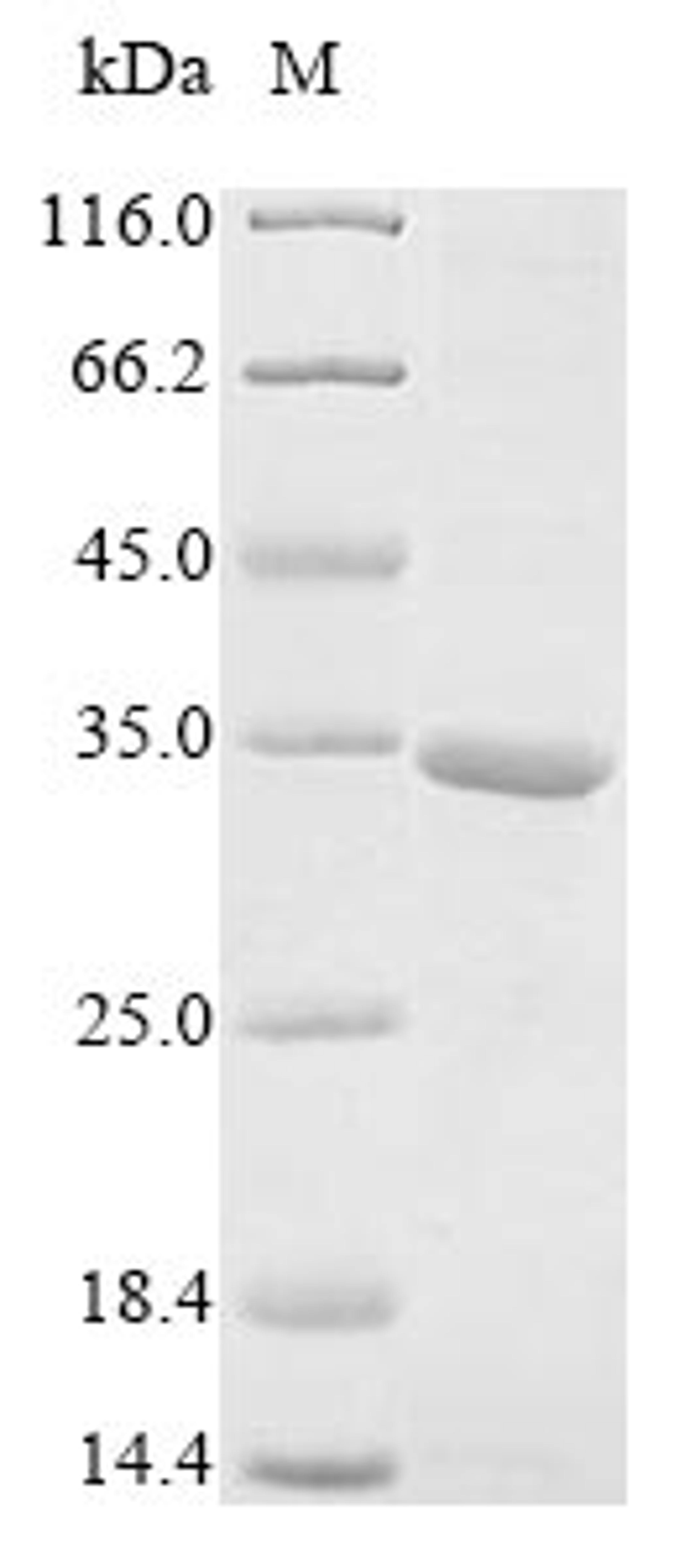 (Tris-Glycine gel) Discontinuous SDS-PAGE (reduced) with 5% enrichment gel and 15% separation gel.