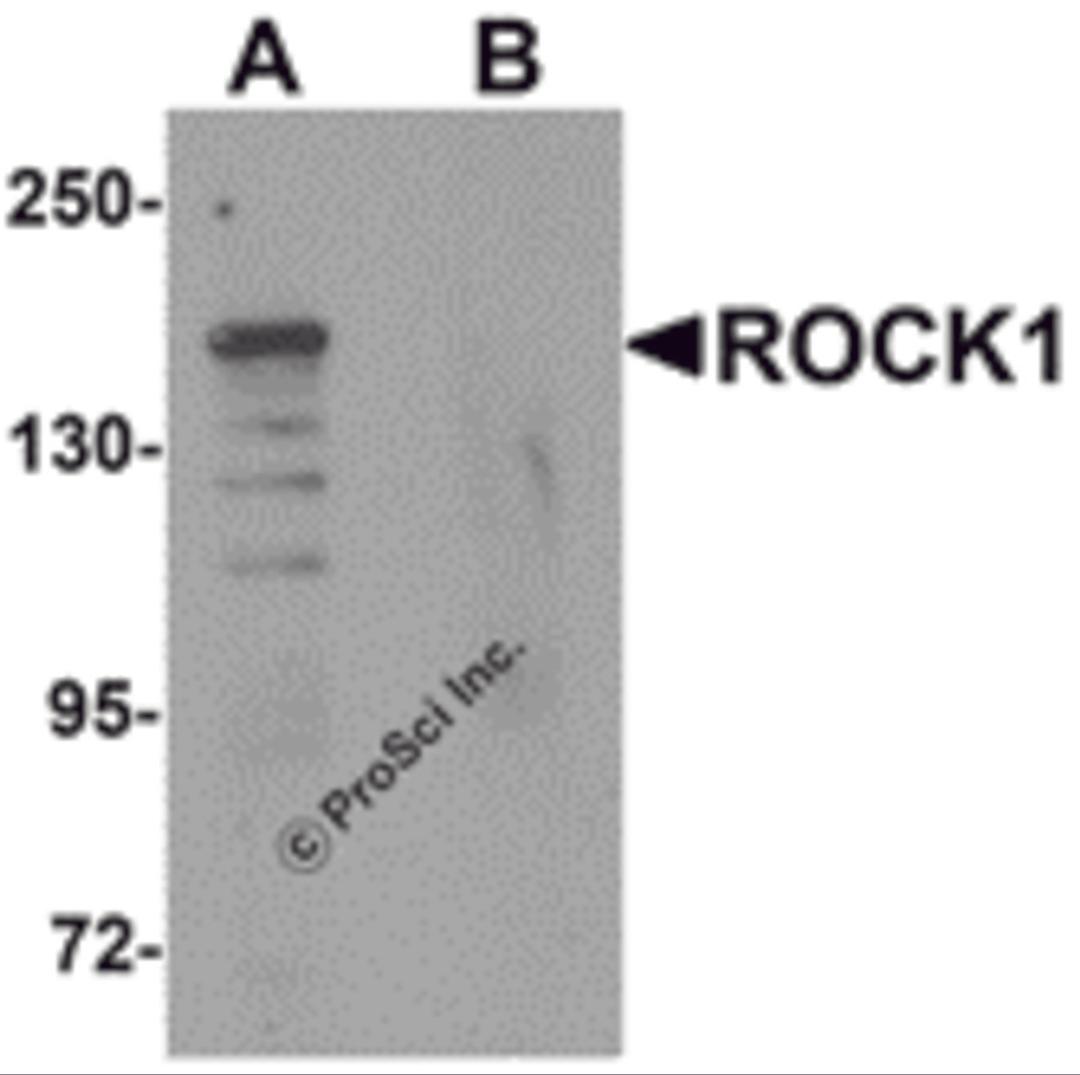 Western blot analysis of ROCK1 in 293 cell lysate with ROCK1 antibody at 1 μg/mL in (A) the absence and (B) the presence of blocking peptide.