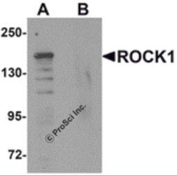 Western blot analysis of ROCK1 in 293 cell lysate with ROCK1 antibody at 1 μg/mL in (A) the absence and (B) the presence of blocking peptide.