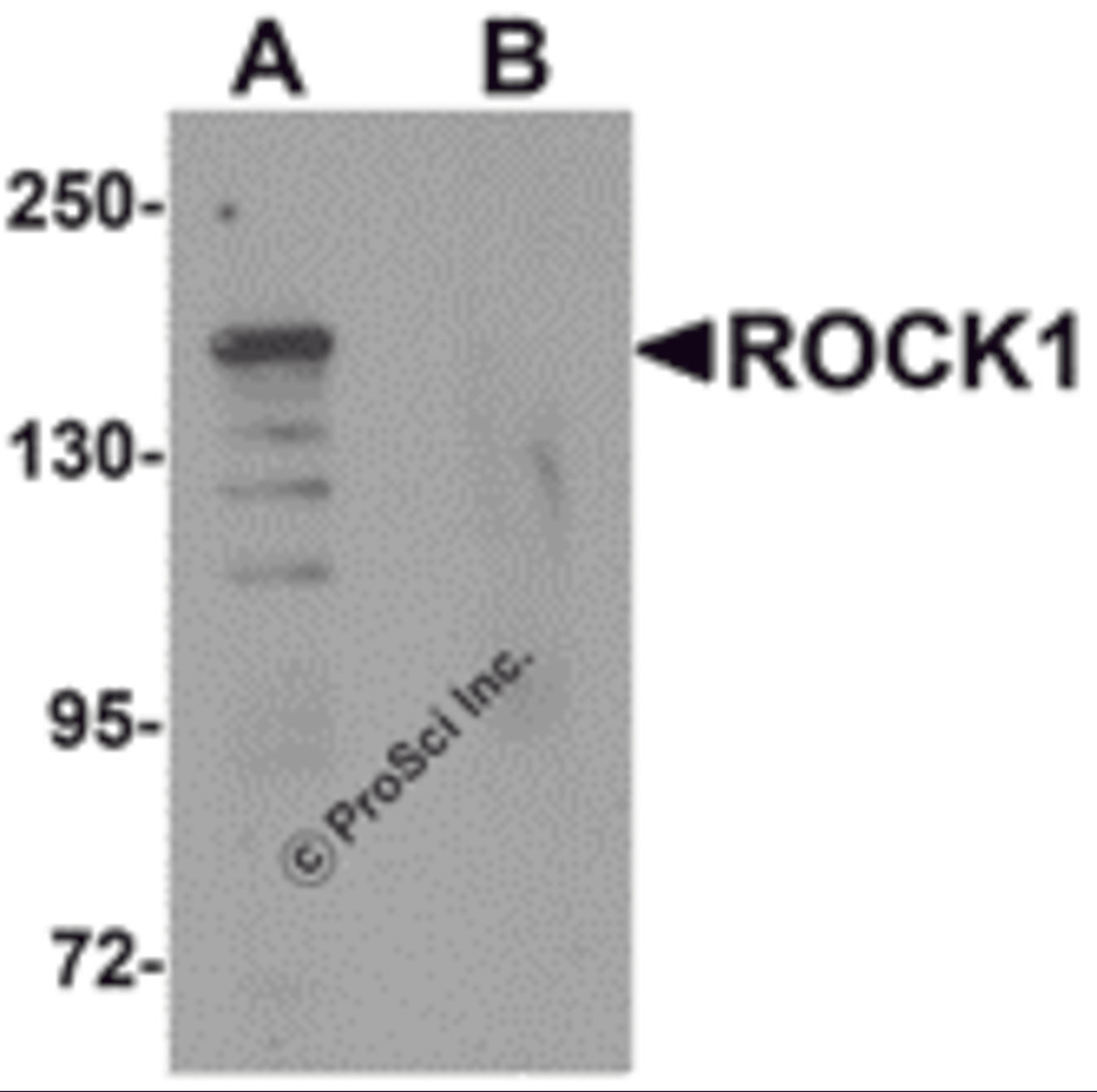 Western blot analysis of ROCK1 in 293 cell lysate with ROCK1 antibody at 1 μg/mL in (A) the absence and (B) the presence of blocking peptide.