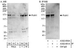 Detection of human and mouse PolA1 by western blot (h&m) and immunoprecipitation (h).