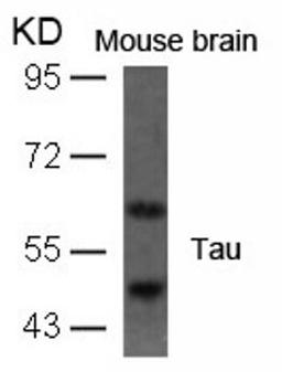 Western blot analysis of lysed extracts from mouse brain tissue using Tau (Ab-396).