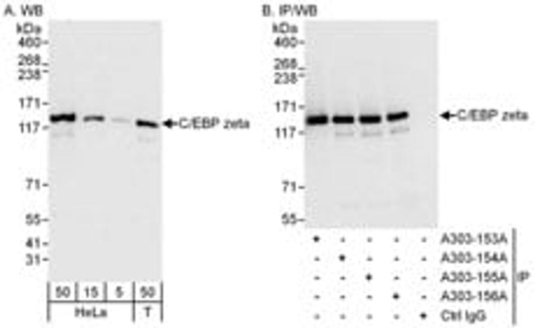 Detection of human C/EBP zeta by western blot and immunoprecipitation.