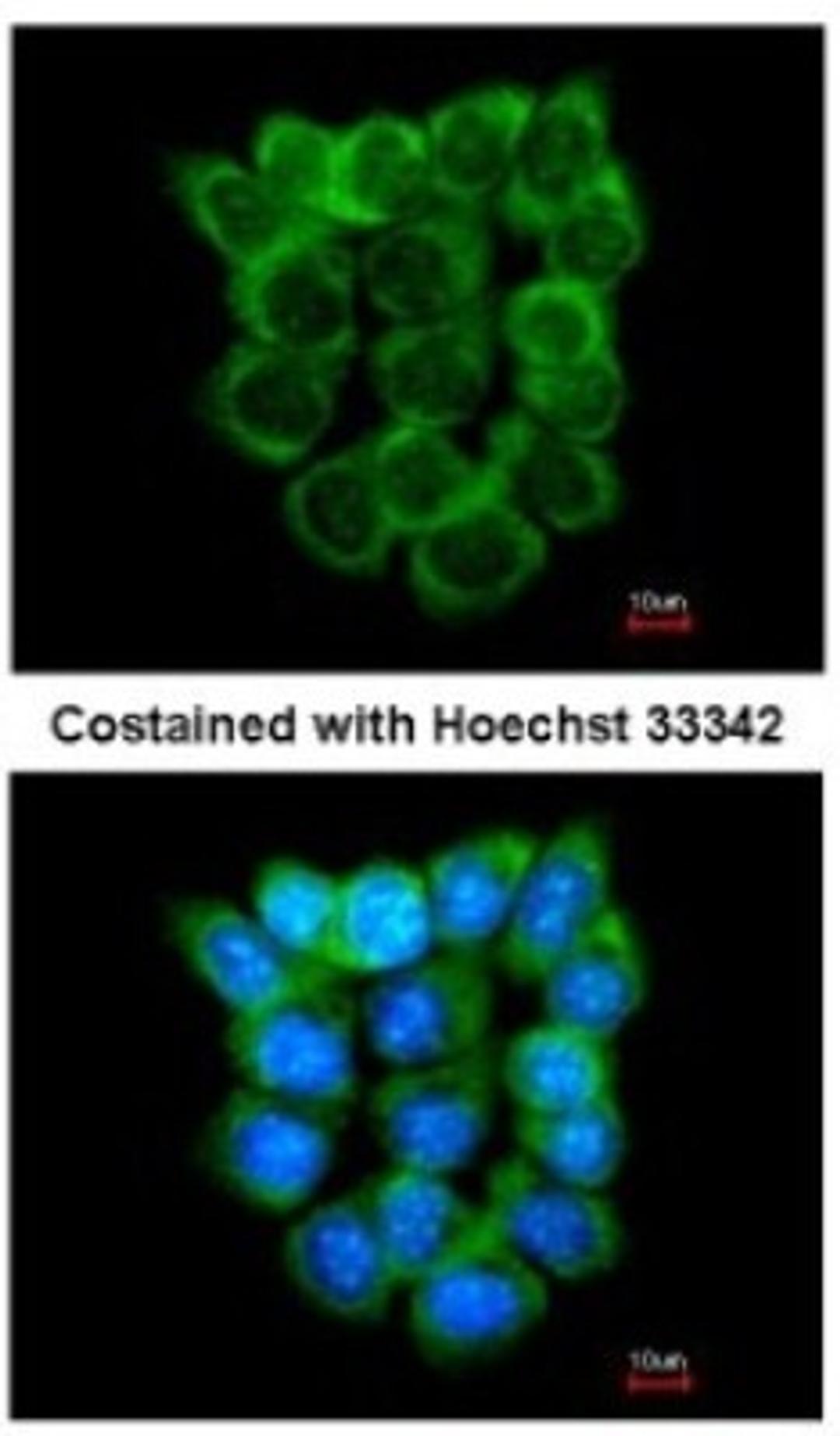 Immunocytochemistry/Immunofluorescence: P2X5 Antibody [NBP2-19658] - Analysis of methanol-fixed A431, using antibody at 1:200 dilution.