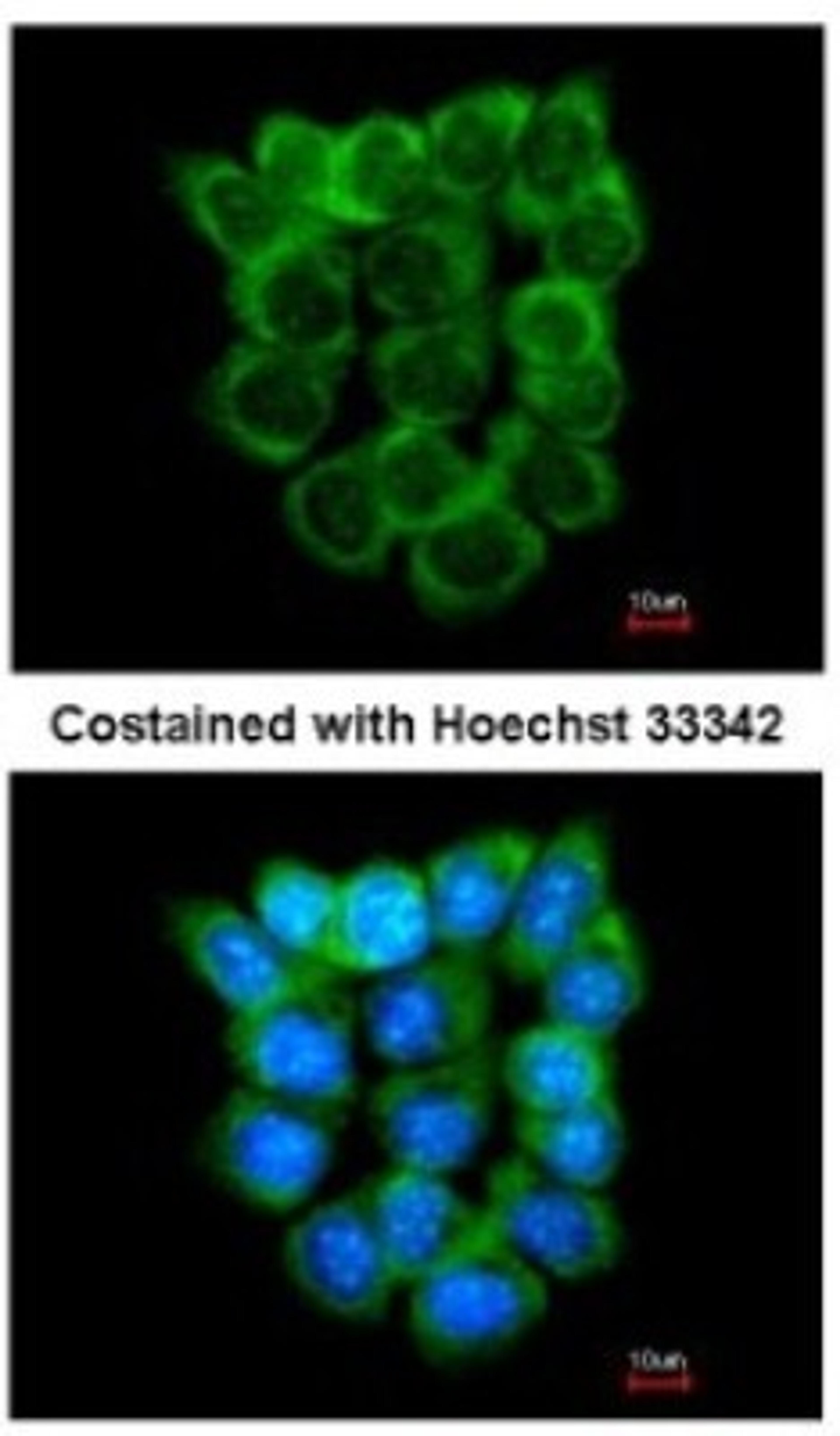 Immunocytochemistry/Immunofluorescence: P2X5 Antibody [NBP2-19658] - Analysis of methanol-fixed A431, using antibody at 1:200 dilution.