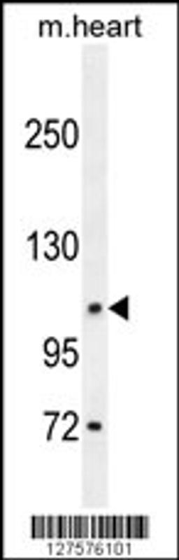 Western blot analysis in mouse heart tissue lysates (35ug/lane).