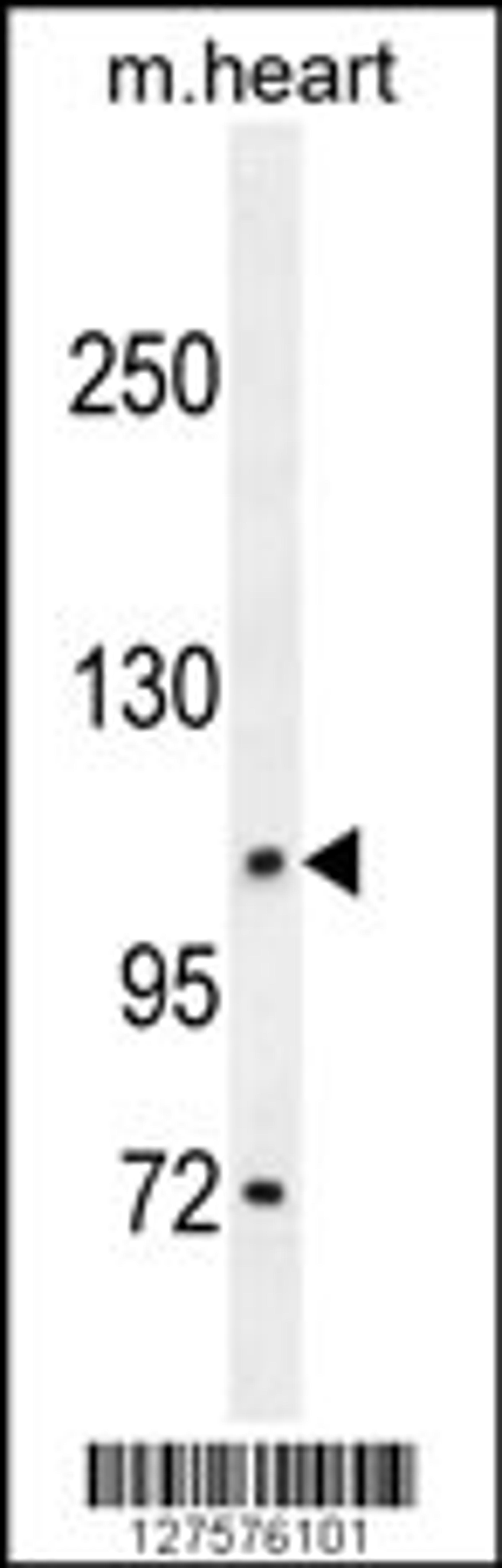 Western blot analysis in mouse heart tissue lysates (35ug/lane).