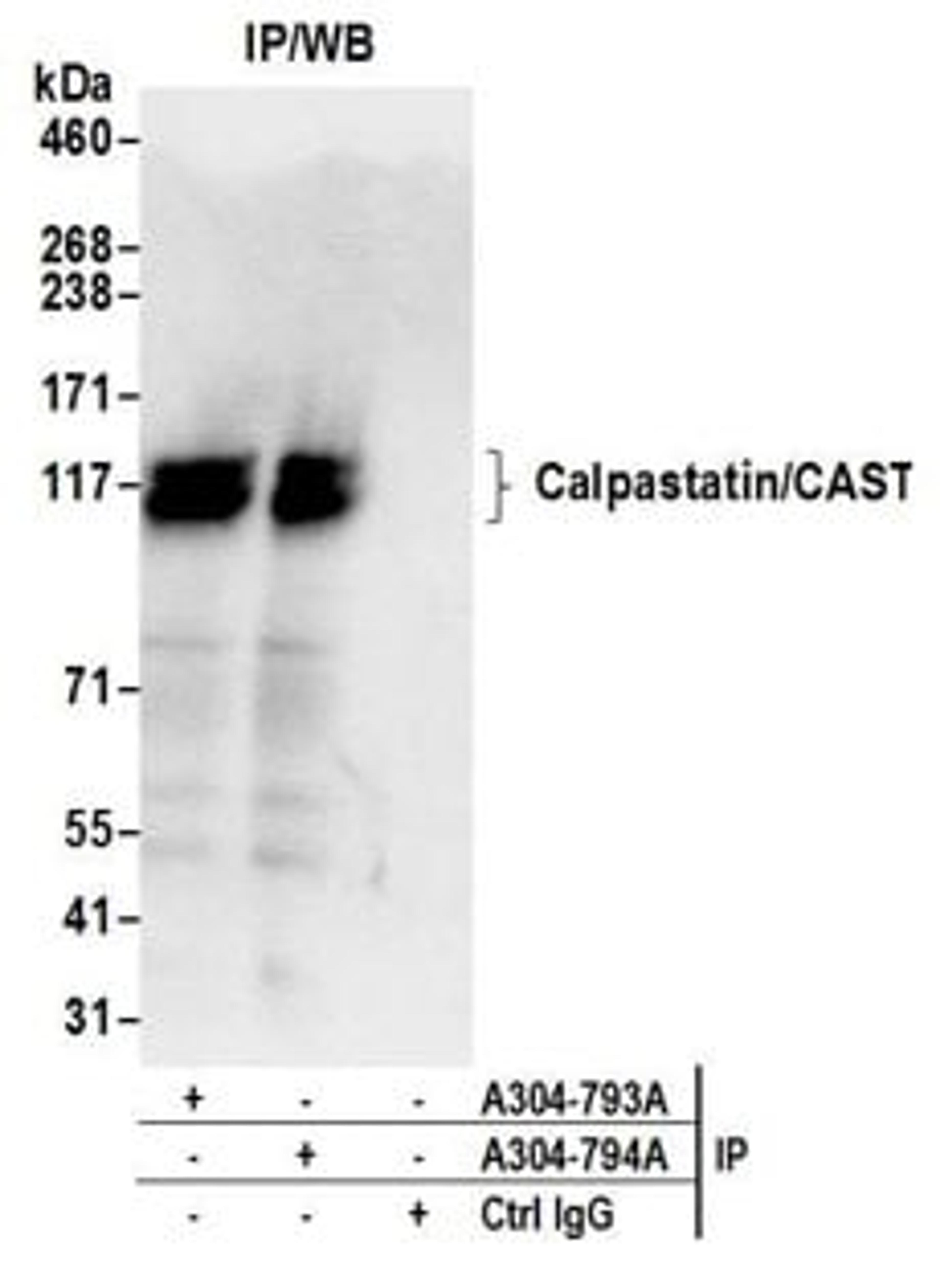 Detection of human Calpastatin/CAST by western blot of immunoprecipitates.