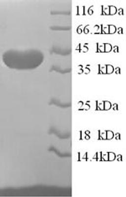 (Tris-Glycine gel) Discontinuous SDS-PAGE (reduced) with 5% enrichment gel and 15% separation gel.