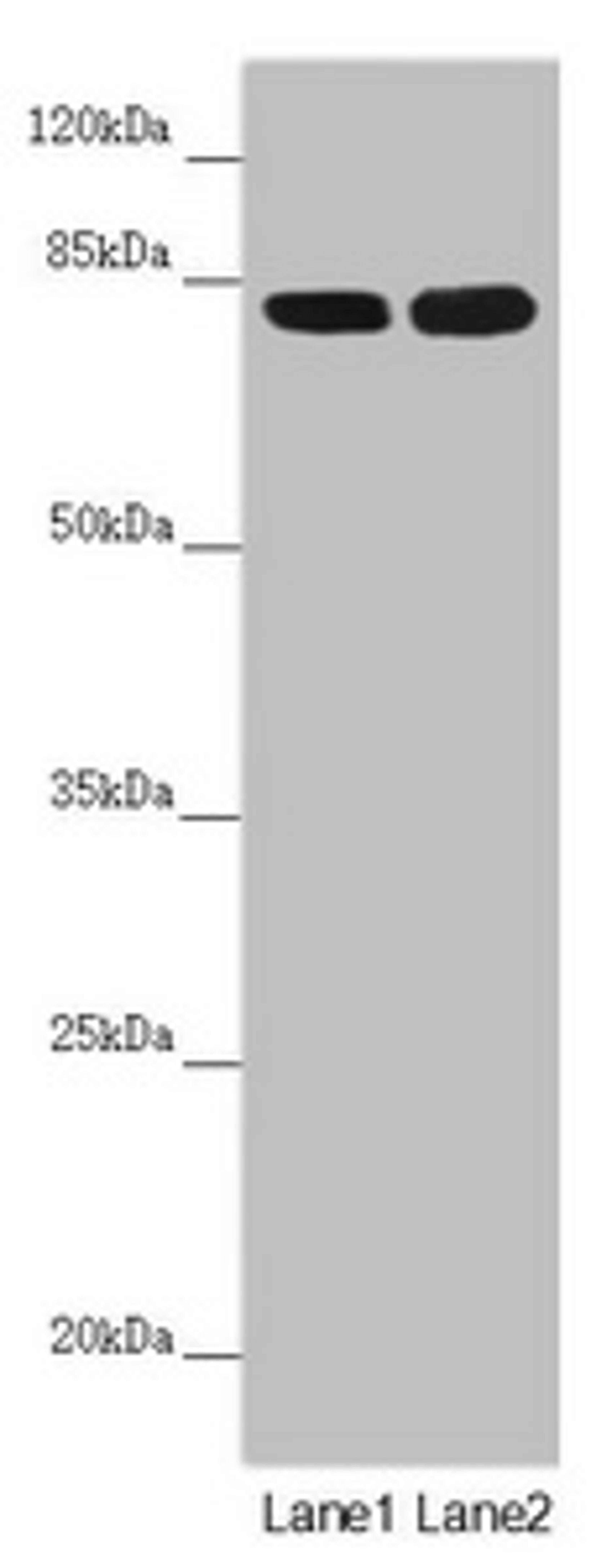 Western blot. All lanes: HOOK2 antibody at 4.11 ug/ml. Lane 1: Mouse small intestine tissue. Lane 2: A431 whole cell lysate. Secondary. Goat polyclonal to rabbit IgG at 1/10000 dilution. Predicted band size: 83 kDa. Observed band size: 83 kDa. 