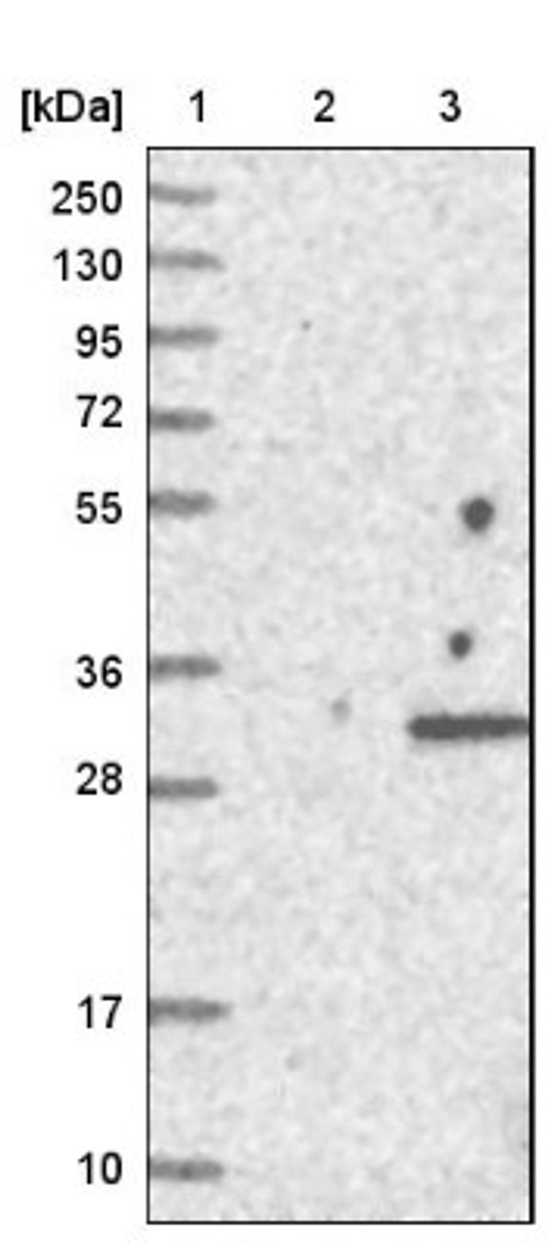 Western Blot: wdyhv1 Antibody [NBP1-86722] - Lane 1: Marker [kDa] 250, 130, 95, 72, 55, 36, 28, 17, 10<br/>Lane 2: Negative control (vector only transfected HEK293T lysate)<br/>Lane 3: Over-expression lysate (Co-expressed with a C-terminal myc-DDK tag (~3.1 kDa) in mammalian HEK293T cells, LY402638)