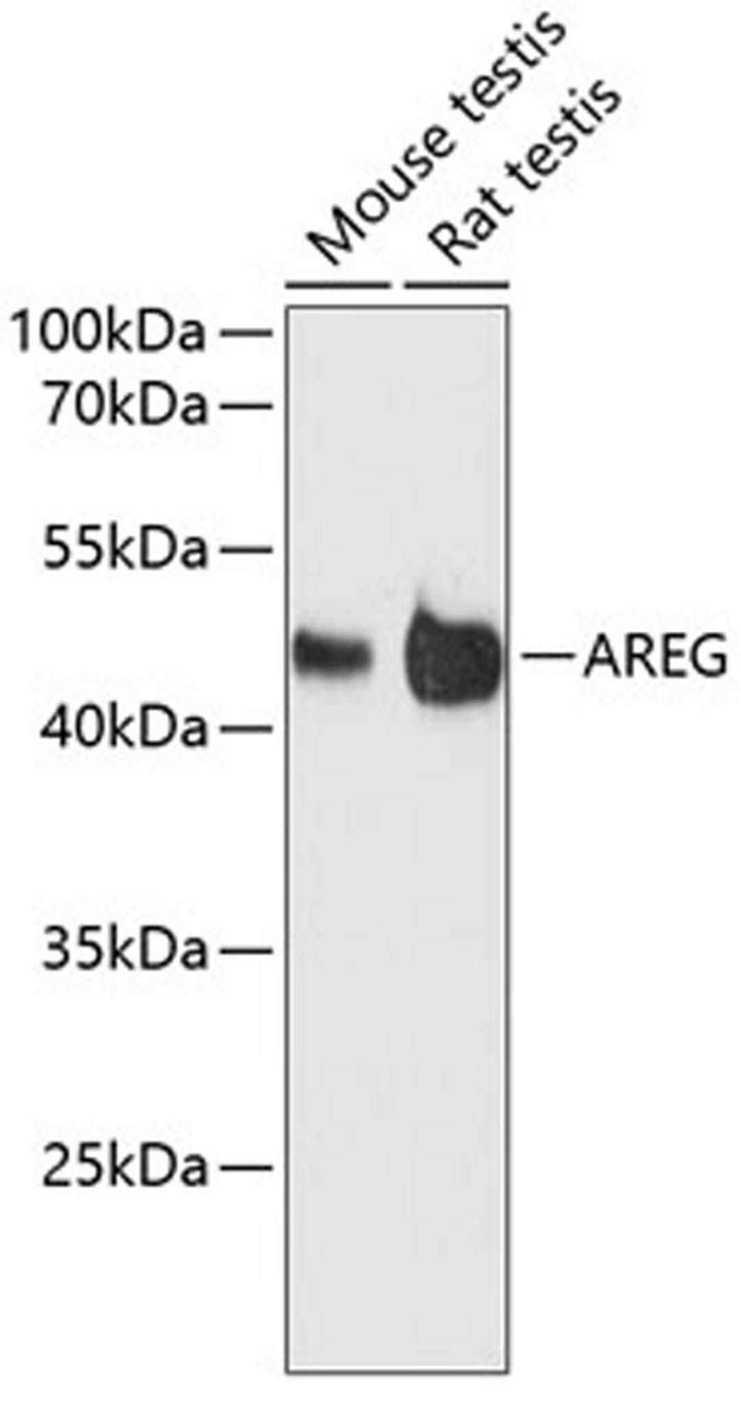 Western blot - AREG antibody (A12680)