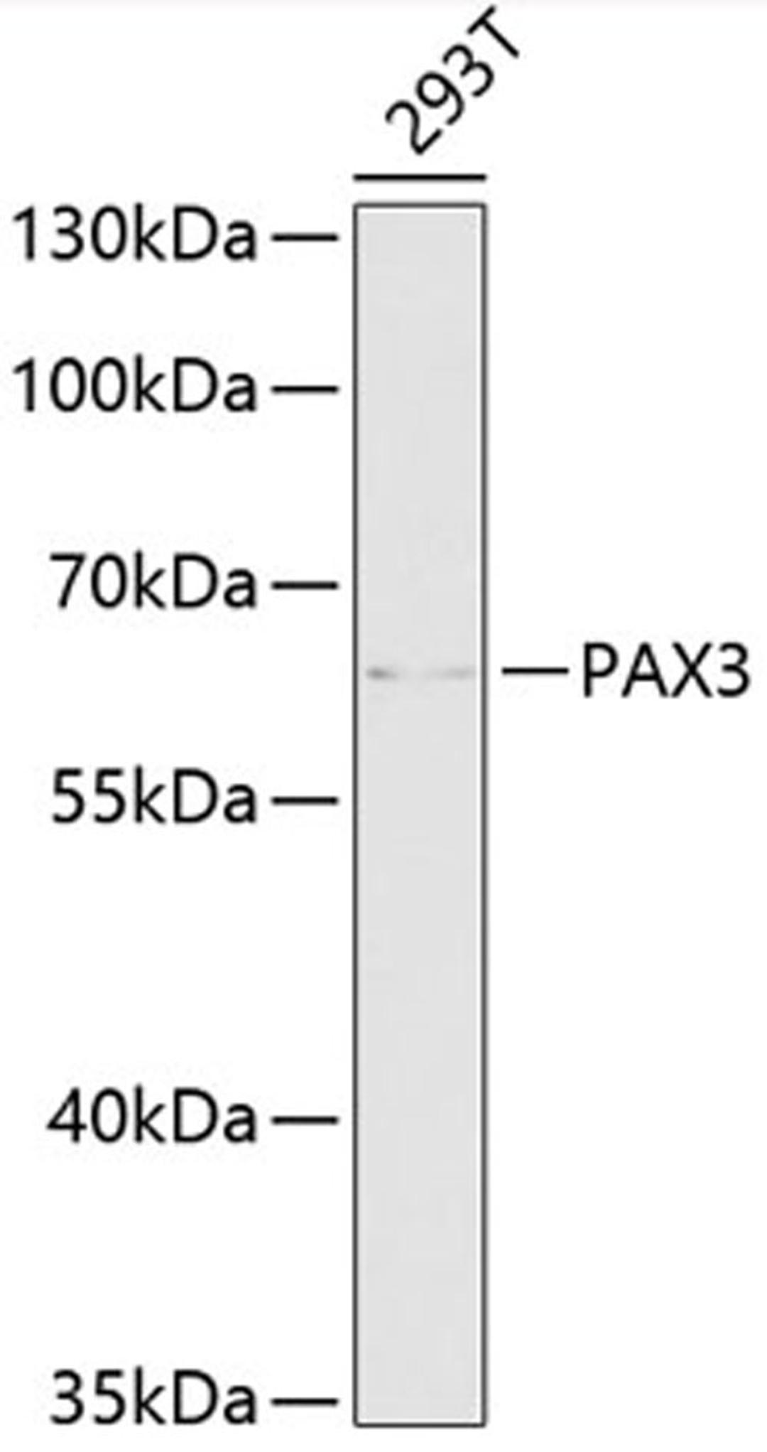 Western blot - PAX3 antibody (A13930)