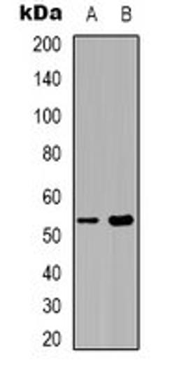 Western blot analysis of COLO205 (Lane 1), Raw264.7 (Lane 2) whole cell lysates using Septin 1 antibody