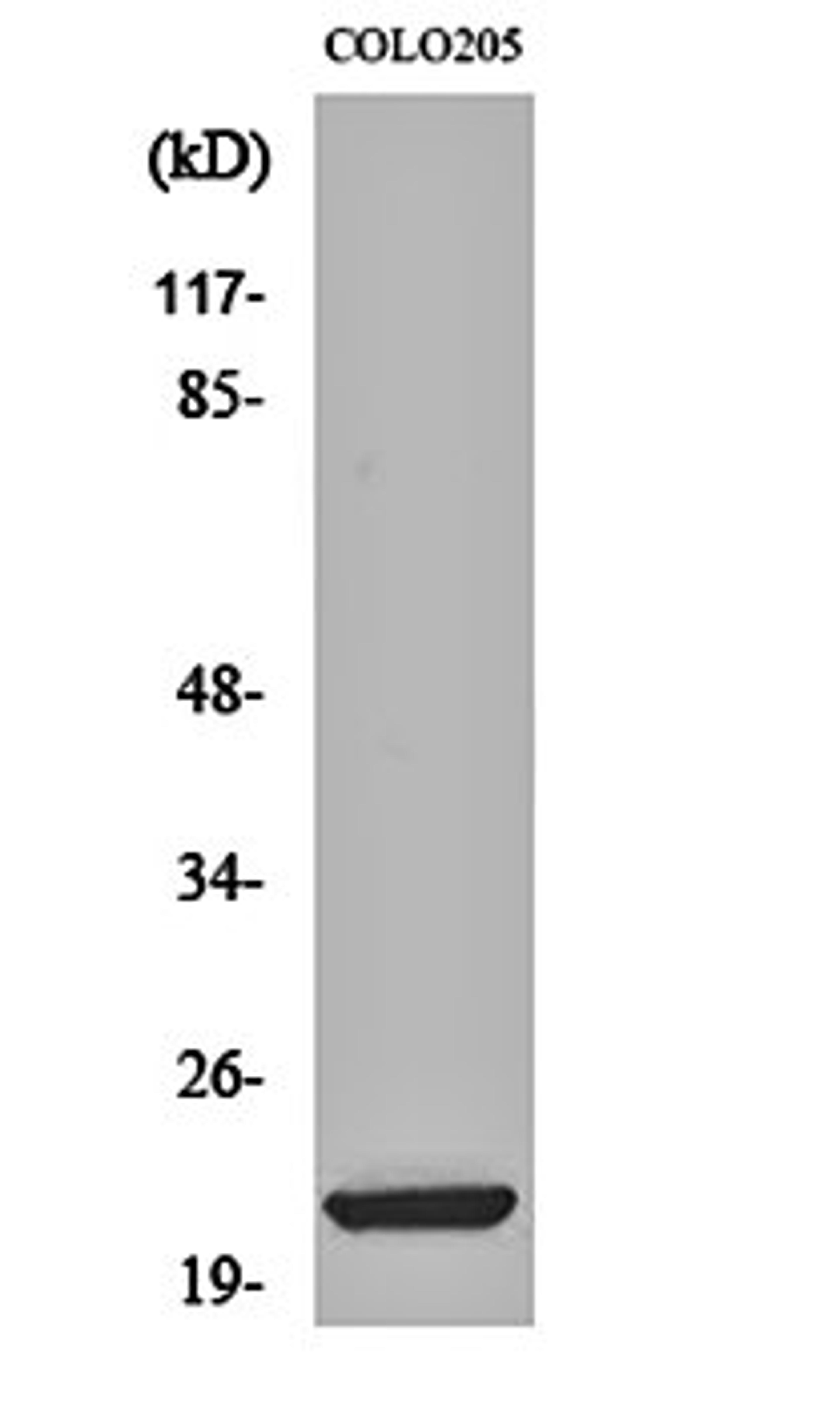 Western blot analysis of COLO205 cell lysates using ML-IAP antibody