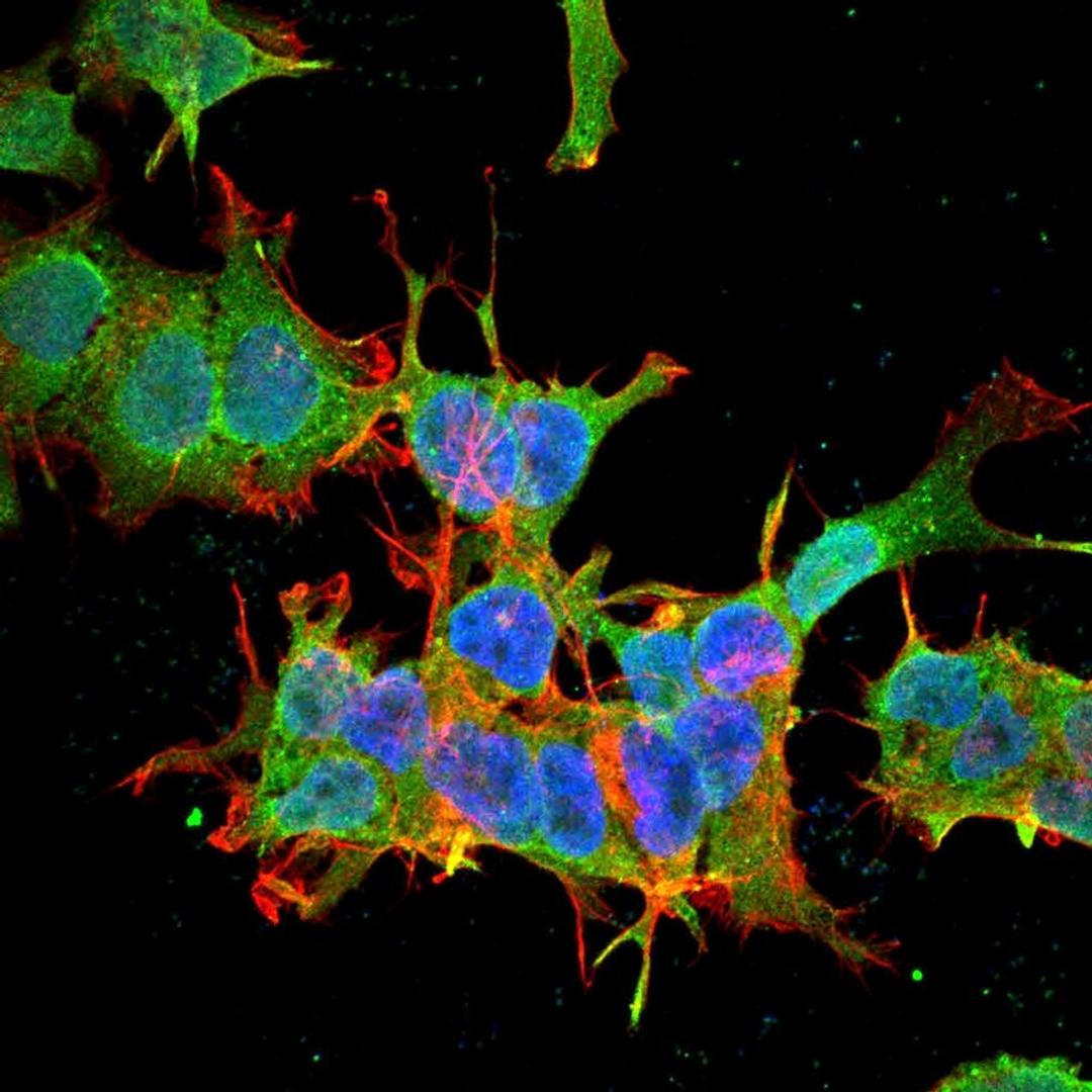 Immunofluorescence analysis of neuroblastoma cell line sk-n-be using beta 4 Spectrin antibody