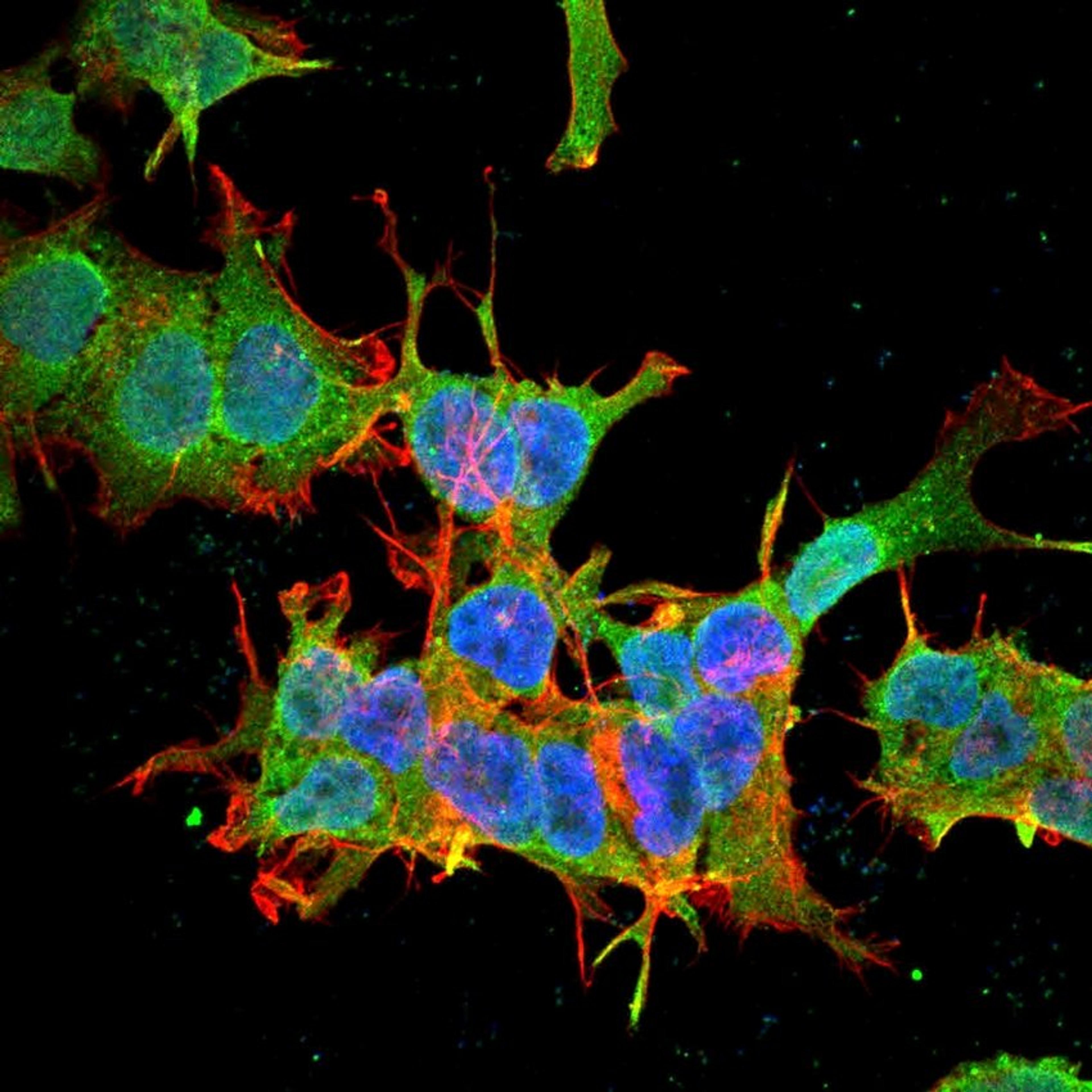 Immunofluorescence analysis of neuroblastoma cell line sk-n-be using beta 4 Spectrin antibody