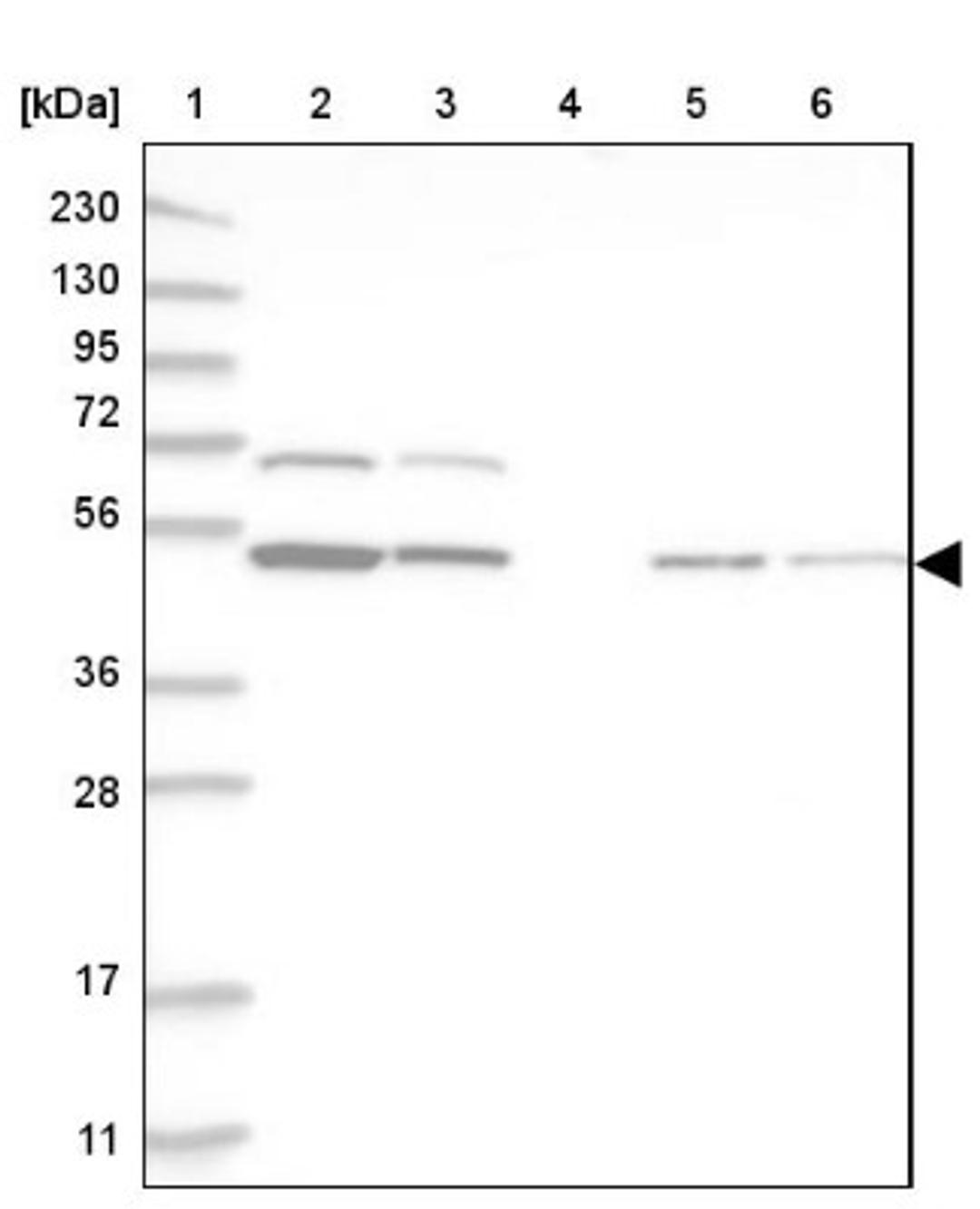 Western Blot: RBM34 Antibody [NBP1-83039] - Lane 1: Marker [kDa] 230, 130, 95, 72, 56, 36, 28, 17, 11<br/>Lane 2: Human cell line RT-4<br/>Lane 3: Human cell line U-251MG sp<br/>Lane 4: Human plasma (IgG/HSA depleted)<br/>Lane 5: Human liver tissue<br/>Lane 6: Human tonsil tissue