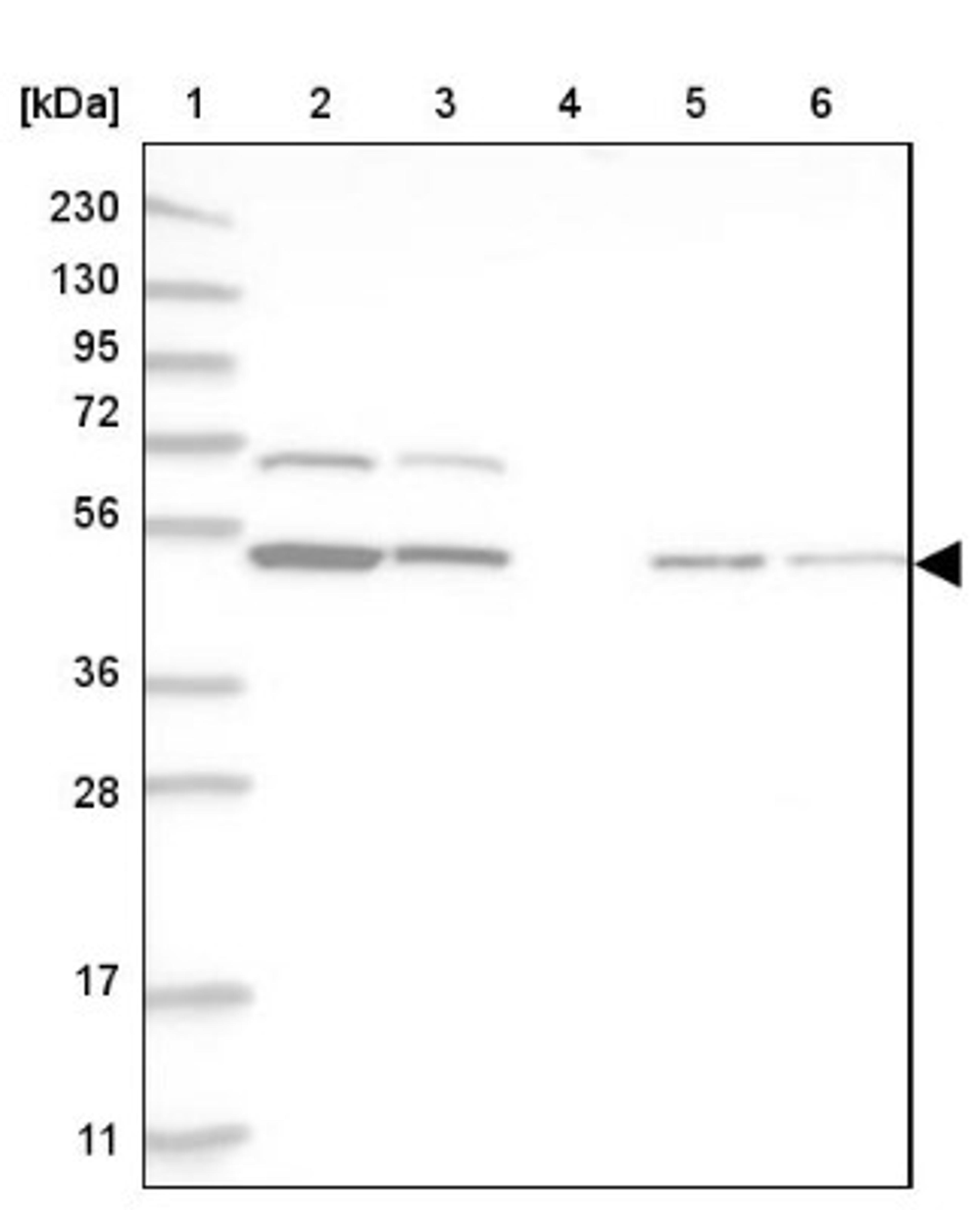 Western Blot: RBM34 Antibody [NBP1-83039] - Lane 1: Marker [kDa] 230, 130, 95, 72, 56, 36, 28, 17, 11<br/>Lane 2: Human cell line RT-4<br/>Lane 3: Human cell line U-251MG sp<br/>Lane 4: Human plasma (IgG/HSA depleted)<br/>Lane 5: Human liver tissue<br/>Lane 6: Human tonsil tissue