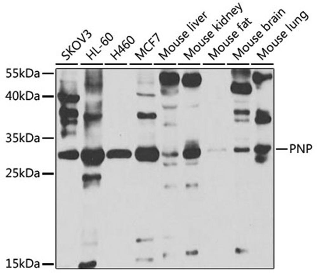 Western blot - PNP antibody (A5778)