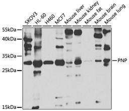 Western blot - PNP antibody (A5778)