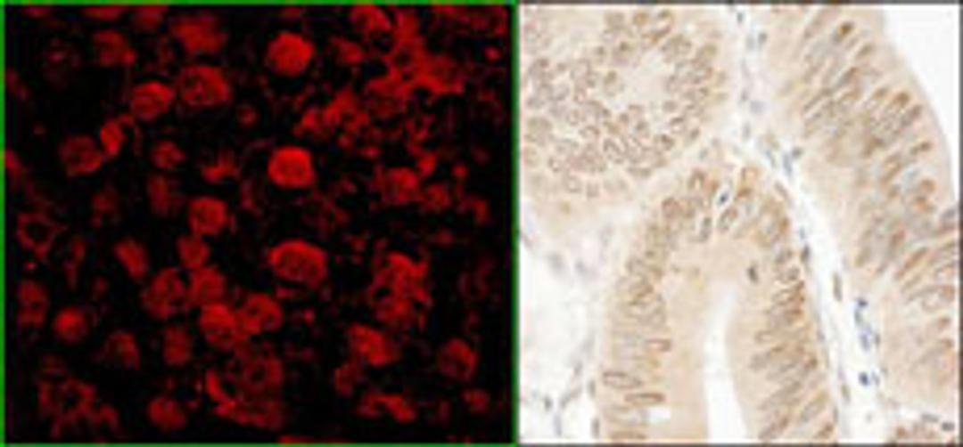 Detection of human NARG1 by immunohistochemistry.