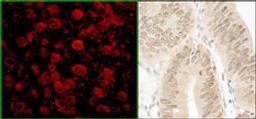 Detection of human NARG1 by immunohistochemistry.