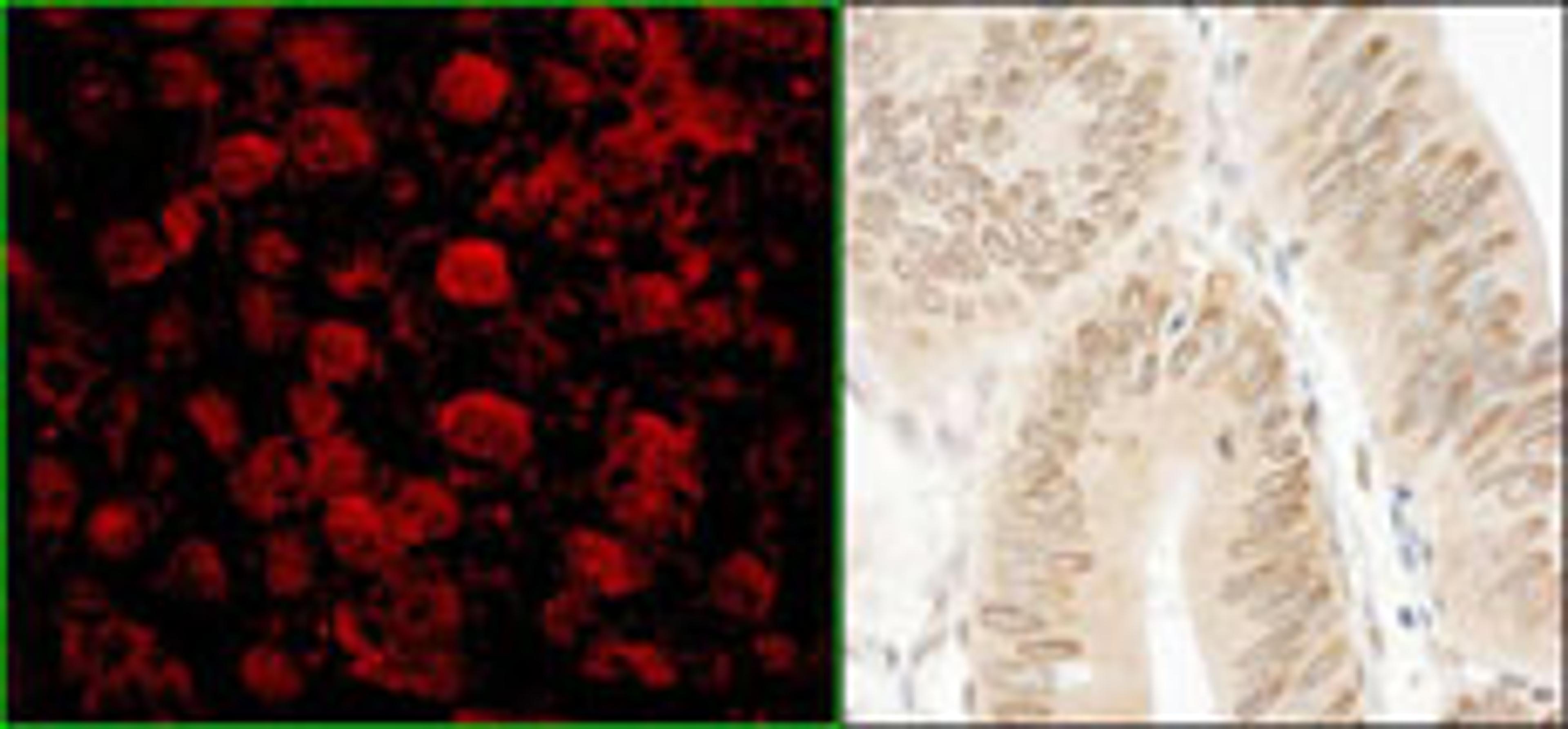 Detection of human NARG1 by immunohistochemistry.