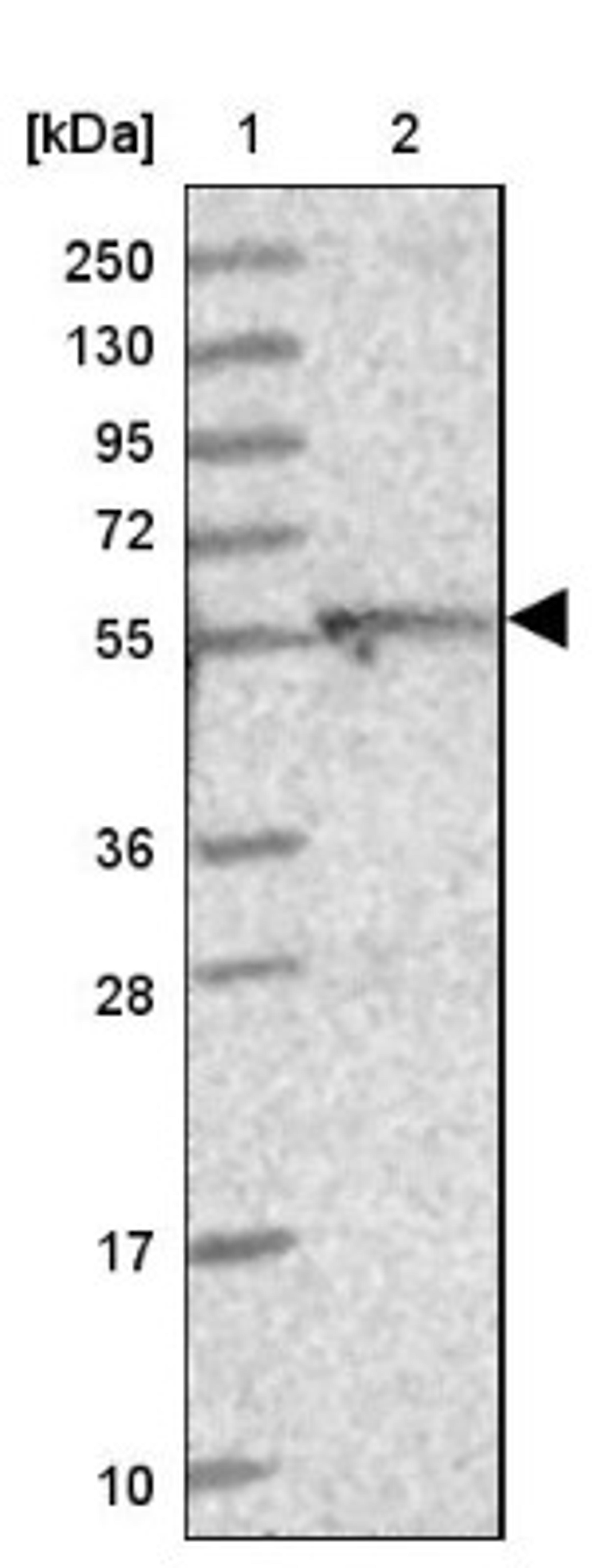 Western Blot: DUS2L Antibody [NBP1-91852] - Lane 1: Marker [kDa] 250, 130, 95, 72, 55, 36, 28, 17, 10<br/>Lane 2: Human cell line RT-4