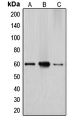 Western blot analysis of HepG2 (Lane 1), Caco2 (Lane 2), A549 (Lane 3) whole cell lysates using CYP27A1 antibody