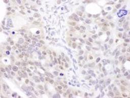 Detection of human Coilin by immunohistochemistry.