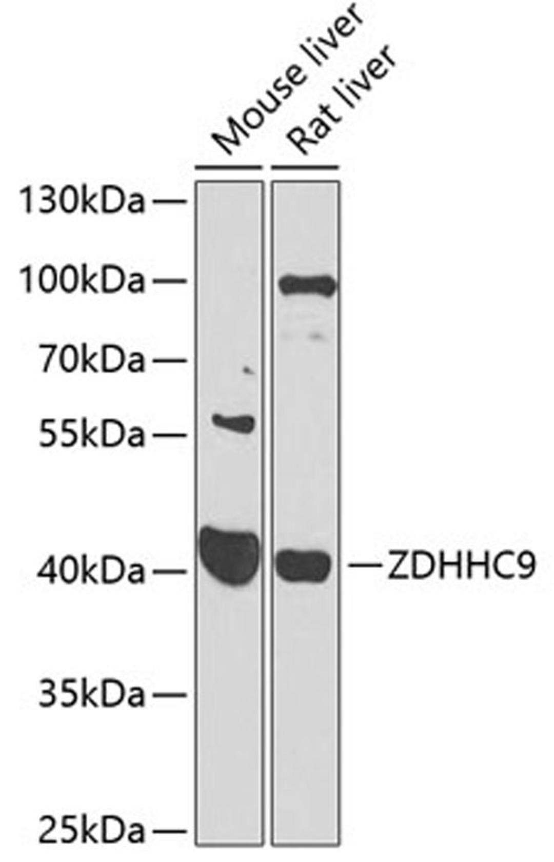 Western blot - ZDHHC9 antibody (A7977)