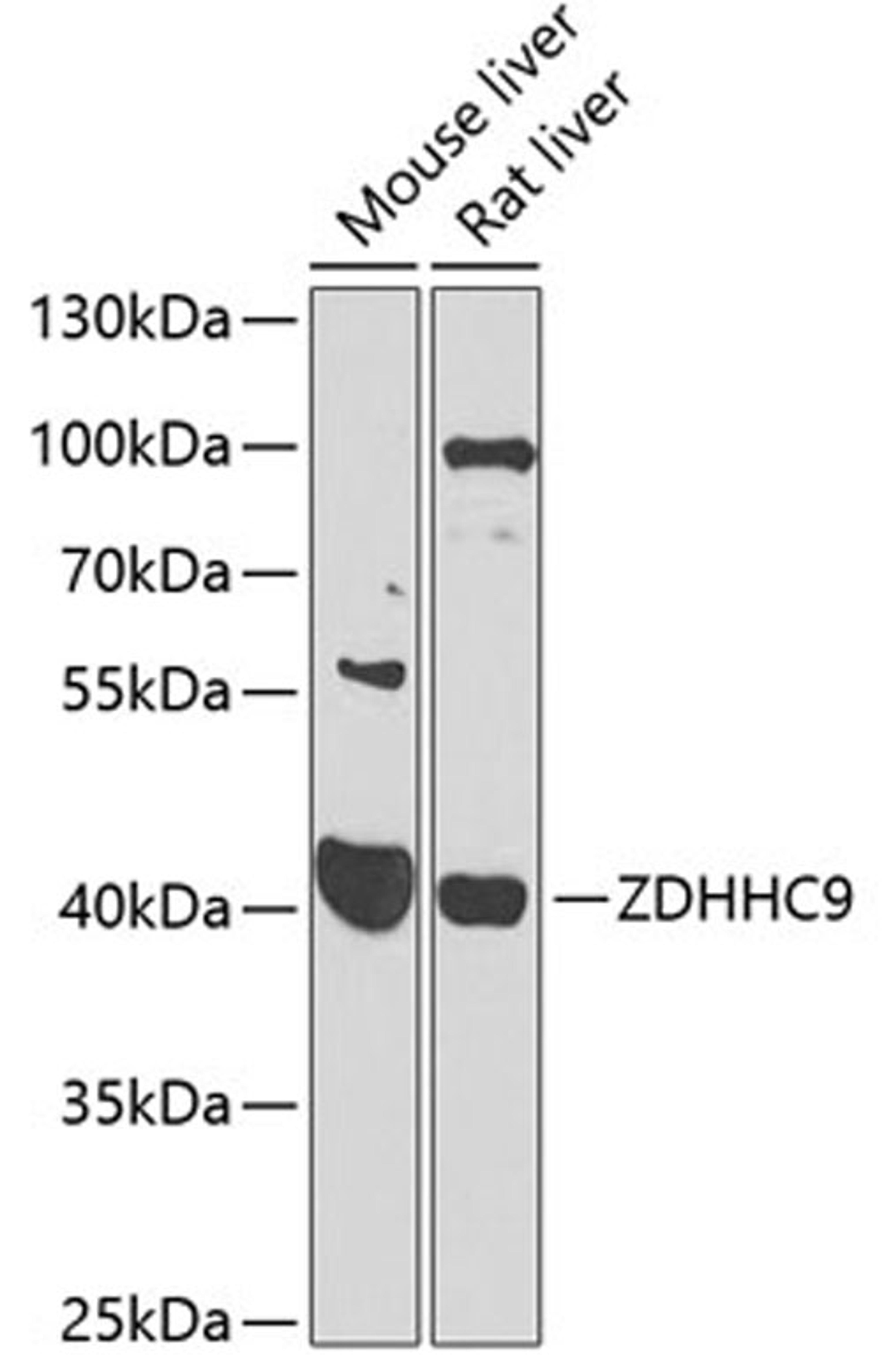 Western blot - ZDHHC9 antibody (A7977)