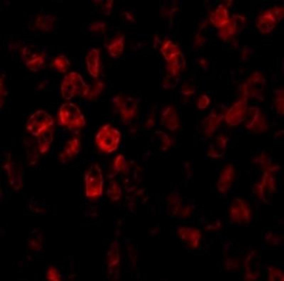 Immunofluorescence: SCO2 Antibody [NBP1-77274] - Human Liver tissue.