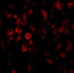 Immunofluorescence: SCO2 Antibody [NBP1-77274] - Human Liver tissue.