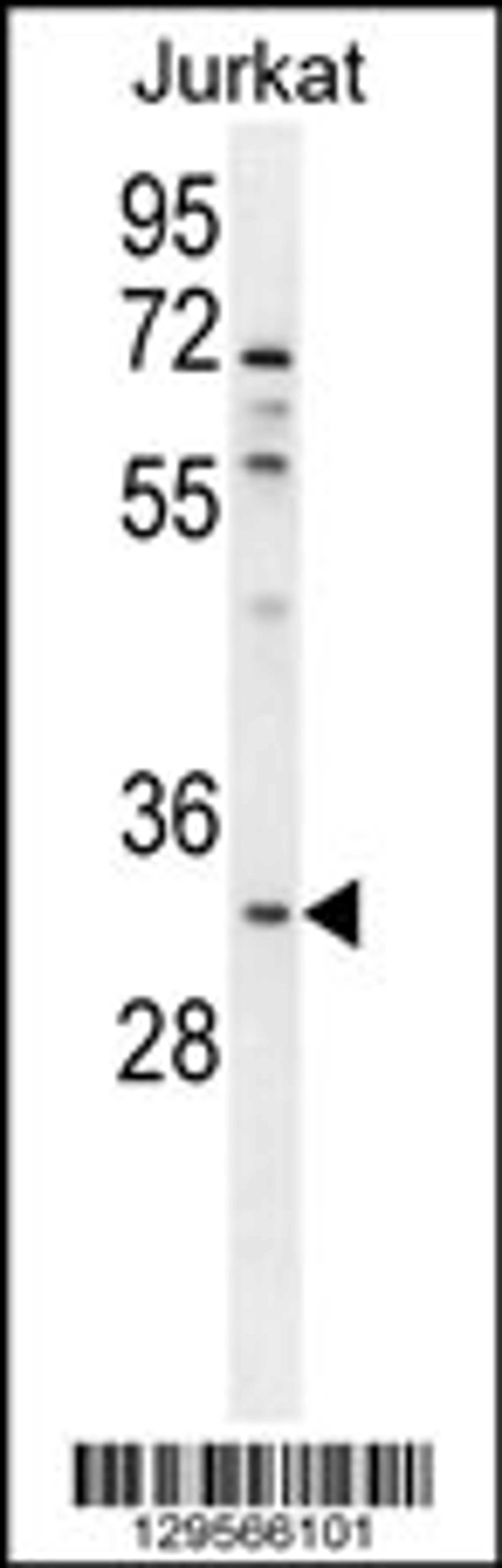 Western blot analysis in Jurkat cell line lysates (35ug/lane).