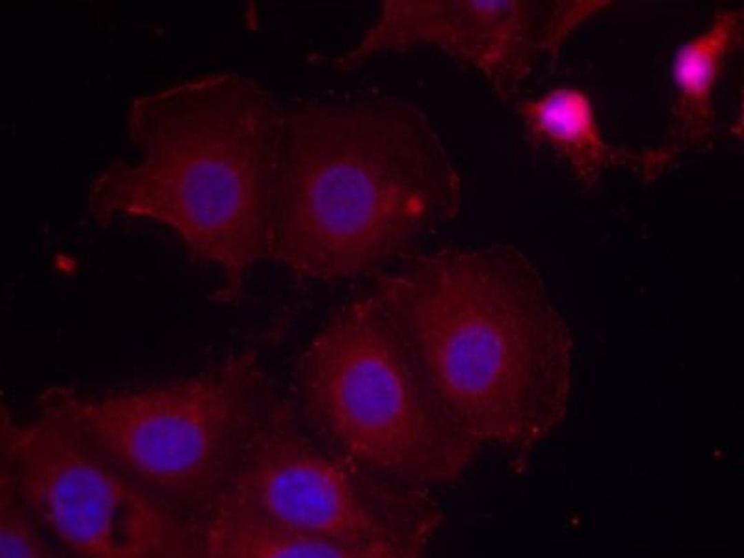 Immunocytochemistry/Immunofluorescence: ErbB2/HER2 [p Tyr877] Antibody [NB100-81961] - Staining of methanol-fixed MCF7 cells using HER2(Phospho-Tyr877) antibody