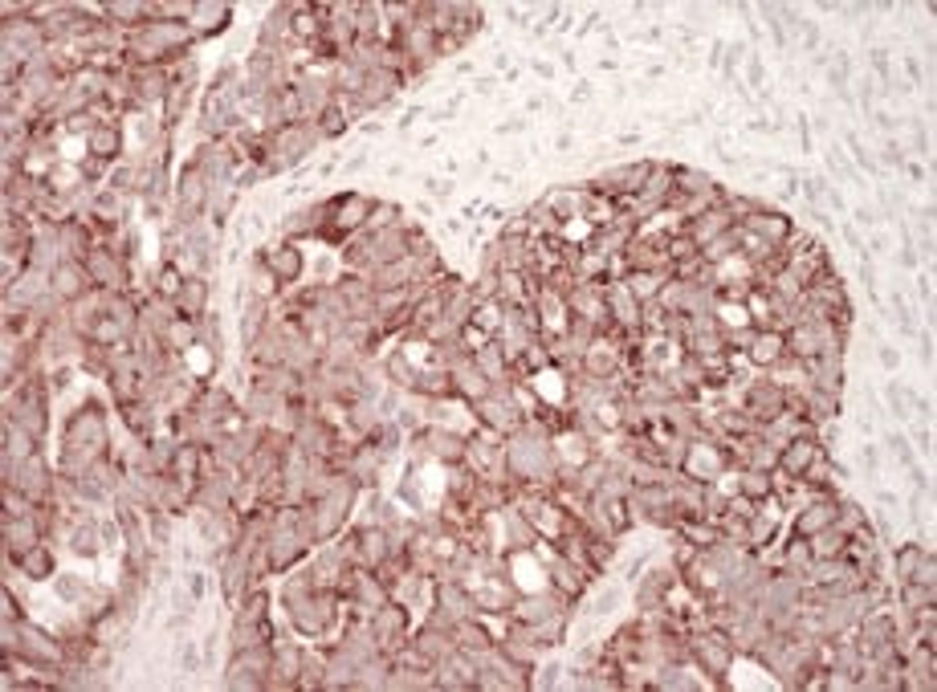 Detection of human HSP60 by immunohistochemistry.