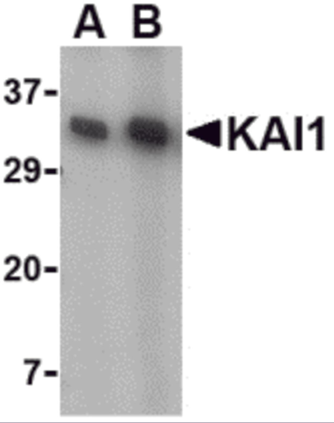 Western blot analysis of KAI1 in A549 cell lysate with KAI1 antibody at (A) 0.5 and (B) 1 μg/mL.