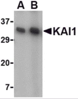 Western blot analysis of KAI1 in A549 cell lysate with KAI1 antibody at (A) 0.5 and (B) 1 μg/mL.