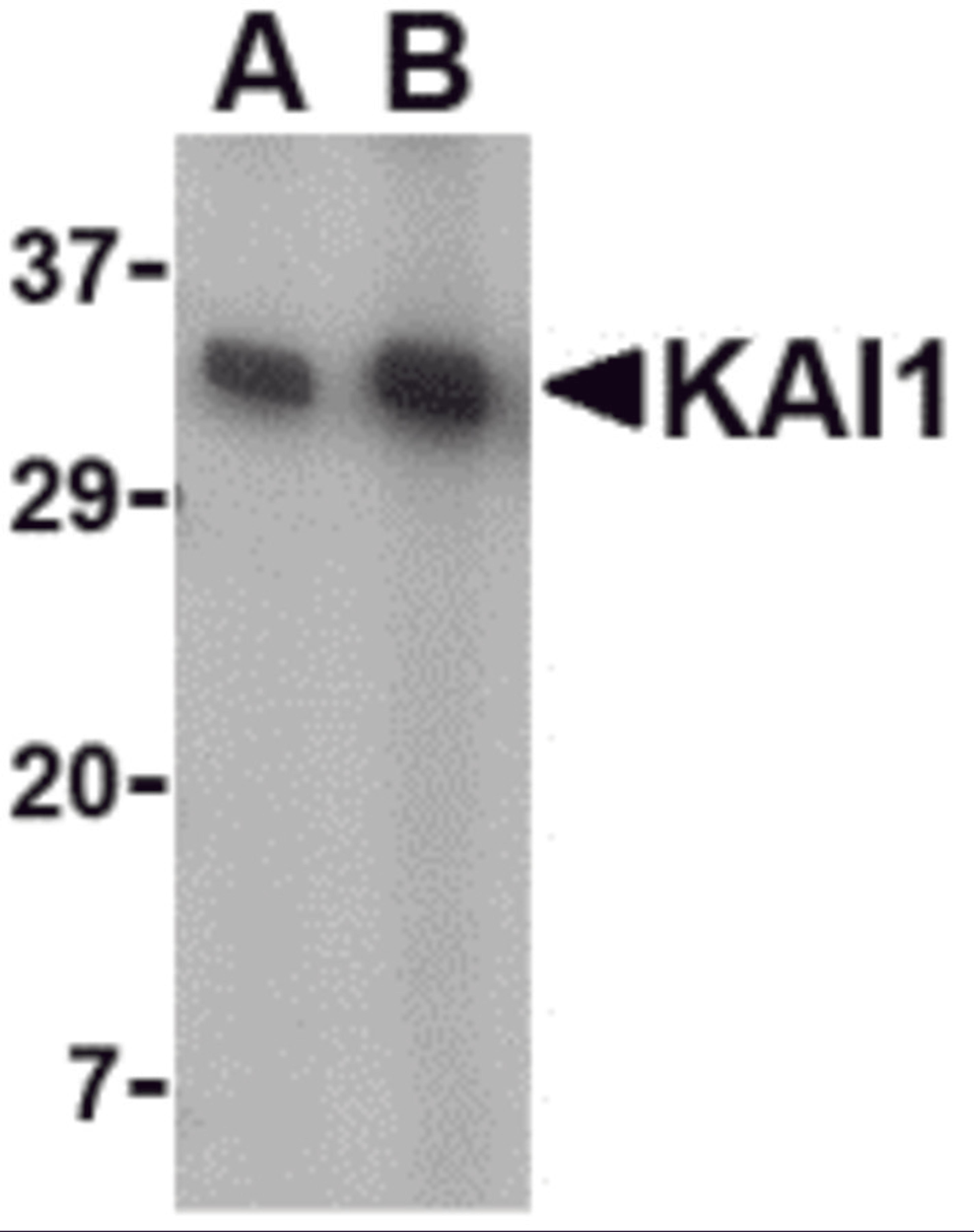 Western blot analysis of KAI1 in A549 cell lysate with KAI1 antibody at (A) 0.5 and (B) 1 μg/mL.