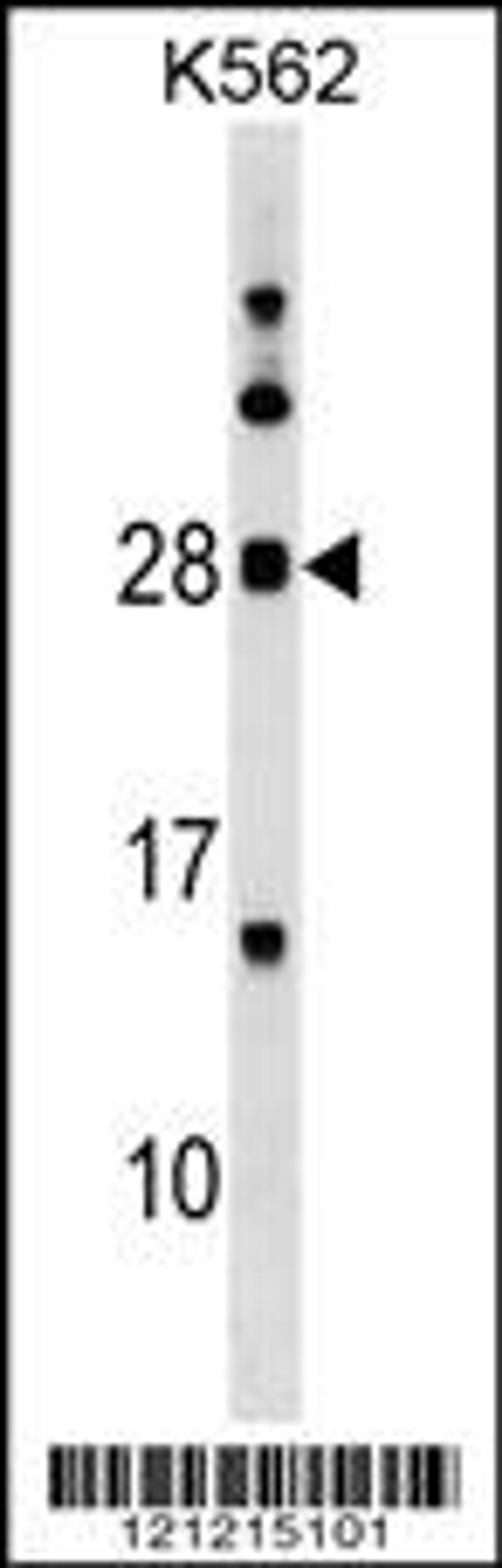 Western blot analysis in K562 cell line lysates (35ug/lane).