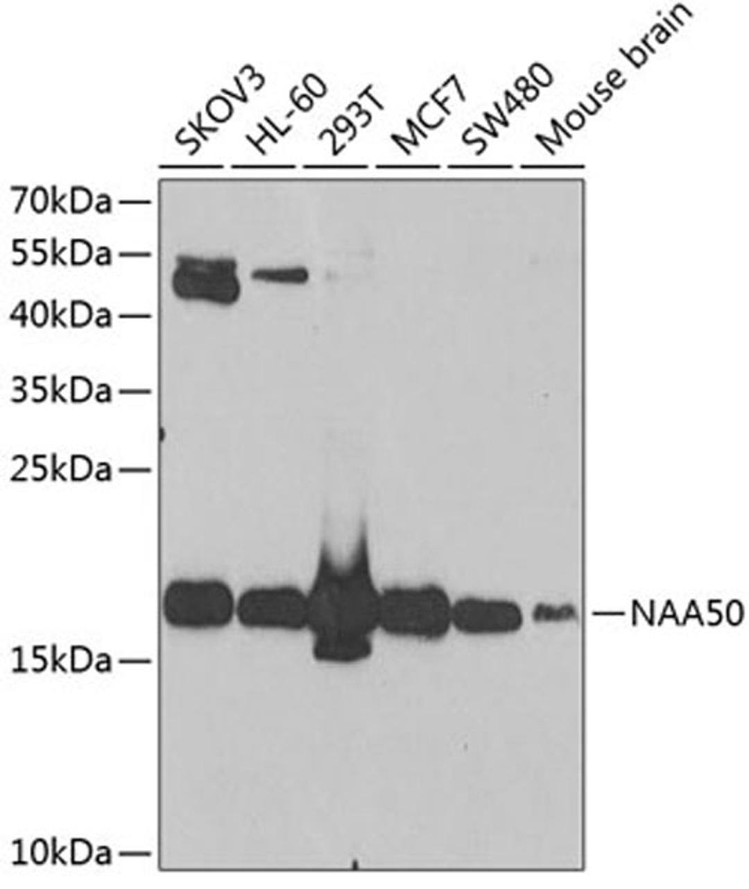 Western blot - NAA50 antibody (A7387)