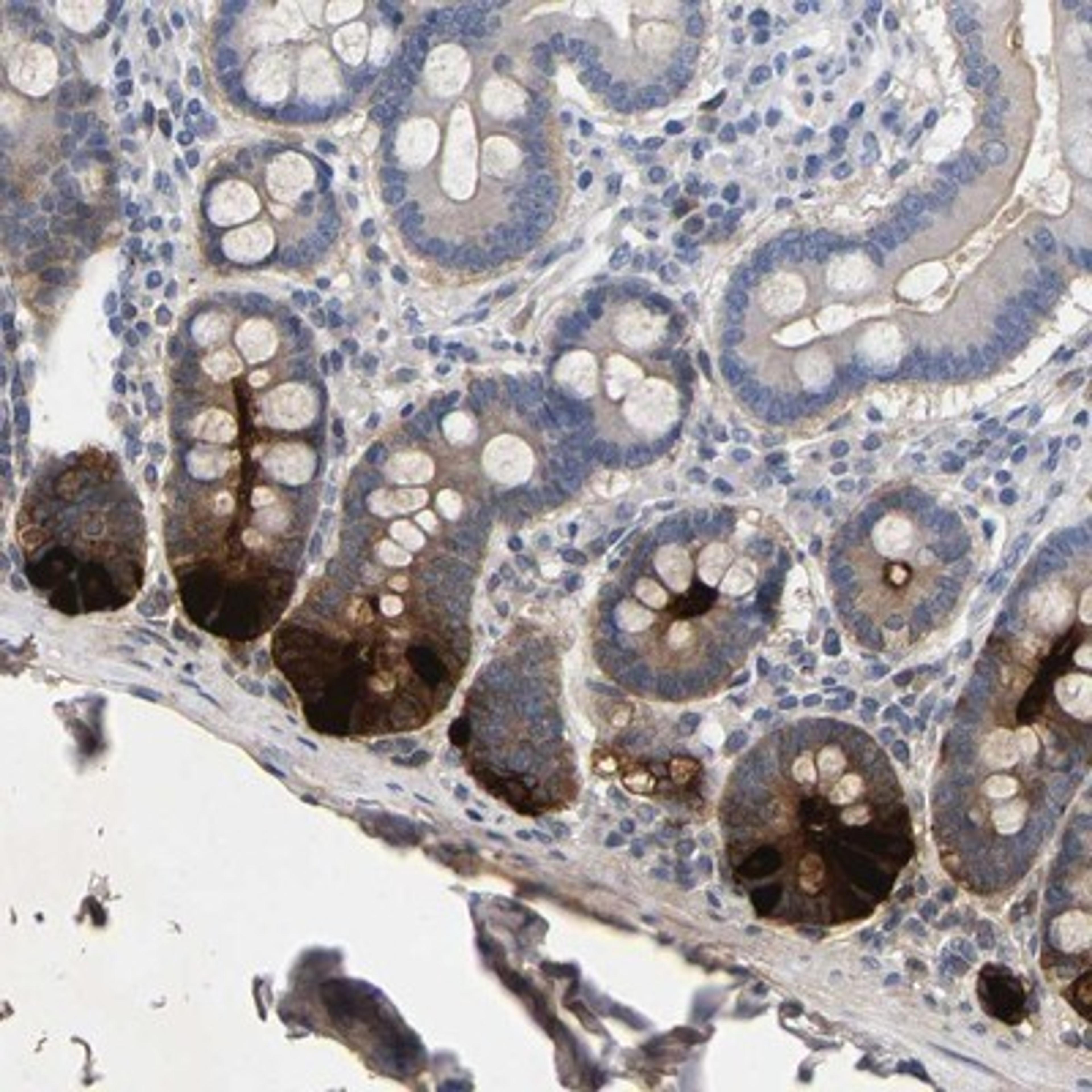 Immunohistochemistry-Paraffin: DEFA6 Antibody [NBP1-84281] - Immunohistochemical staining of human duodenum shows strong cytoplasmic positivity in subsets of glandular cells.