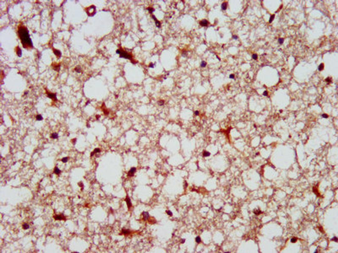 IHC image of CSB-PA614263LA01HU diluted at 1:300 and staining in paraffin-embedded human brain tissue performed on a Leica BondTM system. After dewaxing and hydration, antigen retrieval was mediated by high pressure in a citrate buffer (pH 6.0). Section was blocked with 10% normal goat serum 30min at RT. Then primary antibody (1% BSA) was incubated at 4°C overnight. The primary is detected by a biotinylated secondary antibody and visualized using an HRP conjugated SP system.